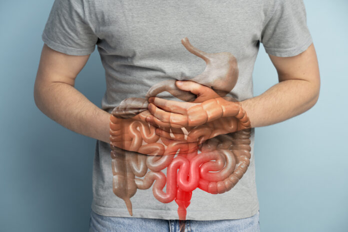symptoms of colon cancer
