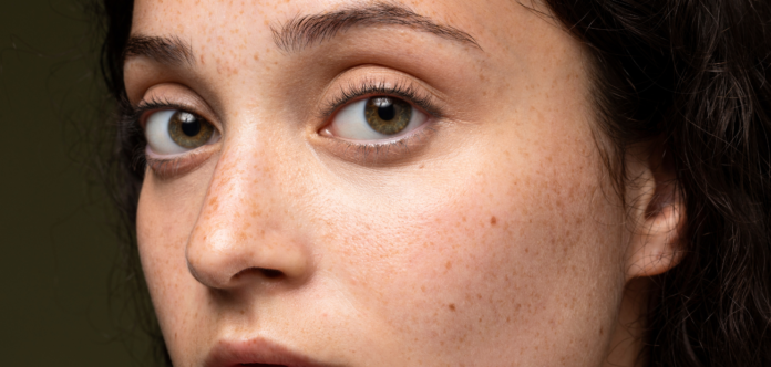 How To Get Rid Of Dark Spots On The Face